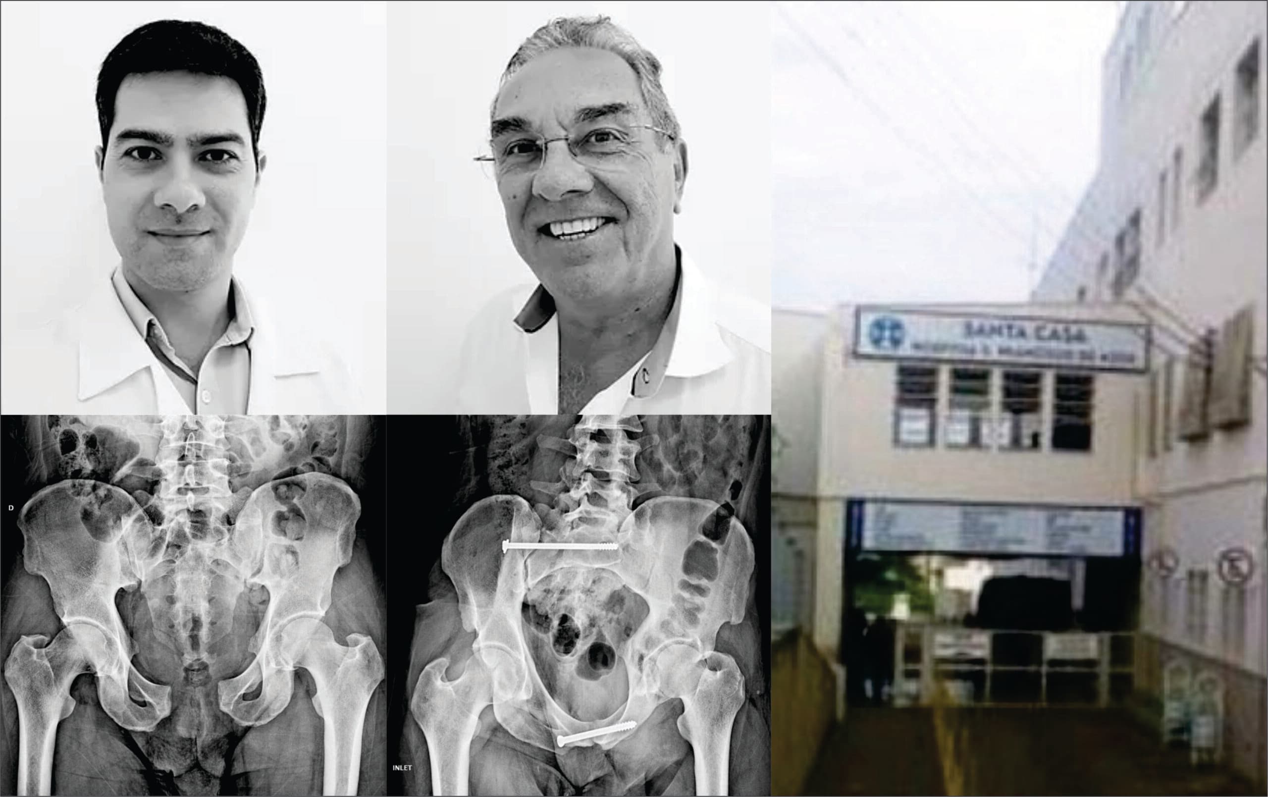 TRÊS PONTAS REALIZA PRIMEIRA CIRURGIA PERCUTÂNEA DE BACIA DO SUL DE MINAS